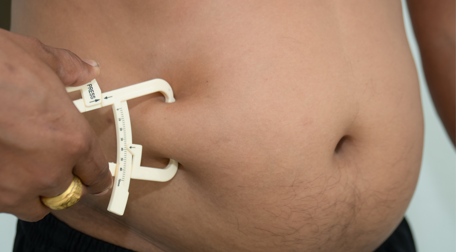 Black and Bariatric: Considerations for Treating the Black Bariatric Surgery Community